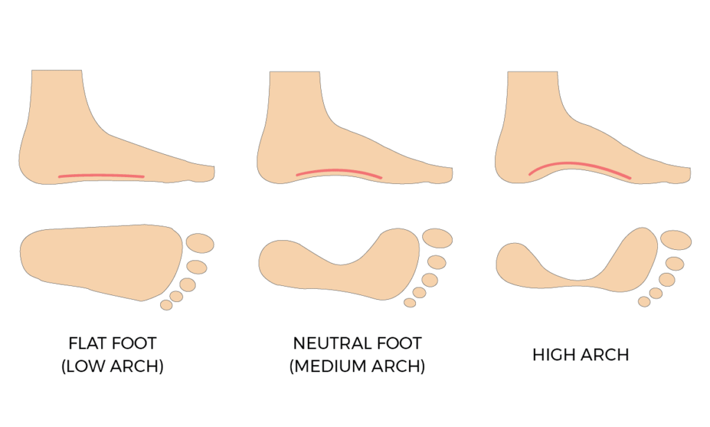 Infografis panduan memilih sepatu lari untuk flat feet, neutral arch, dan high arches - Neo Dash Peak